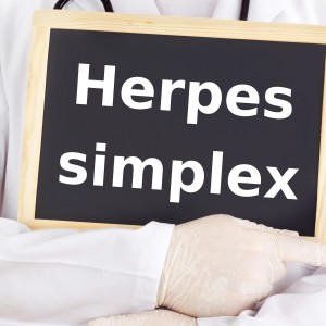 Herpes simplex HSV genital herpes