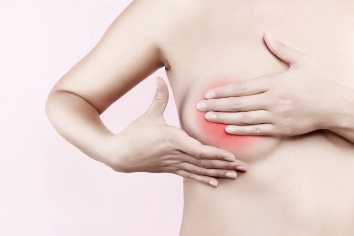 Fibrocystic Breasts | Lumpy Breasts | Fibroadenoma | Naturopath