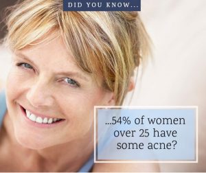 Acne Treatment That Works | How to Have Clearer Skin