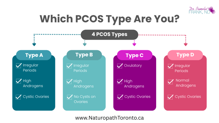 PCOS Types: A Closer Look at the PCOS Spectrum picture of the four pcos phenotypes and the symptoms of the different PCOS phenotypes, which PCOS type are you?